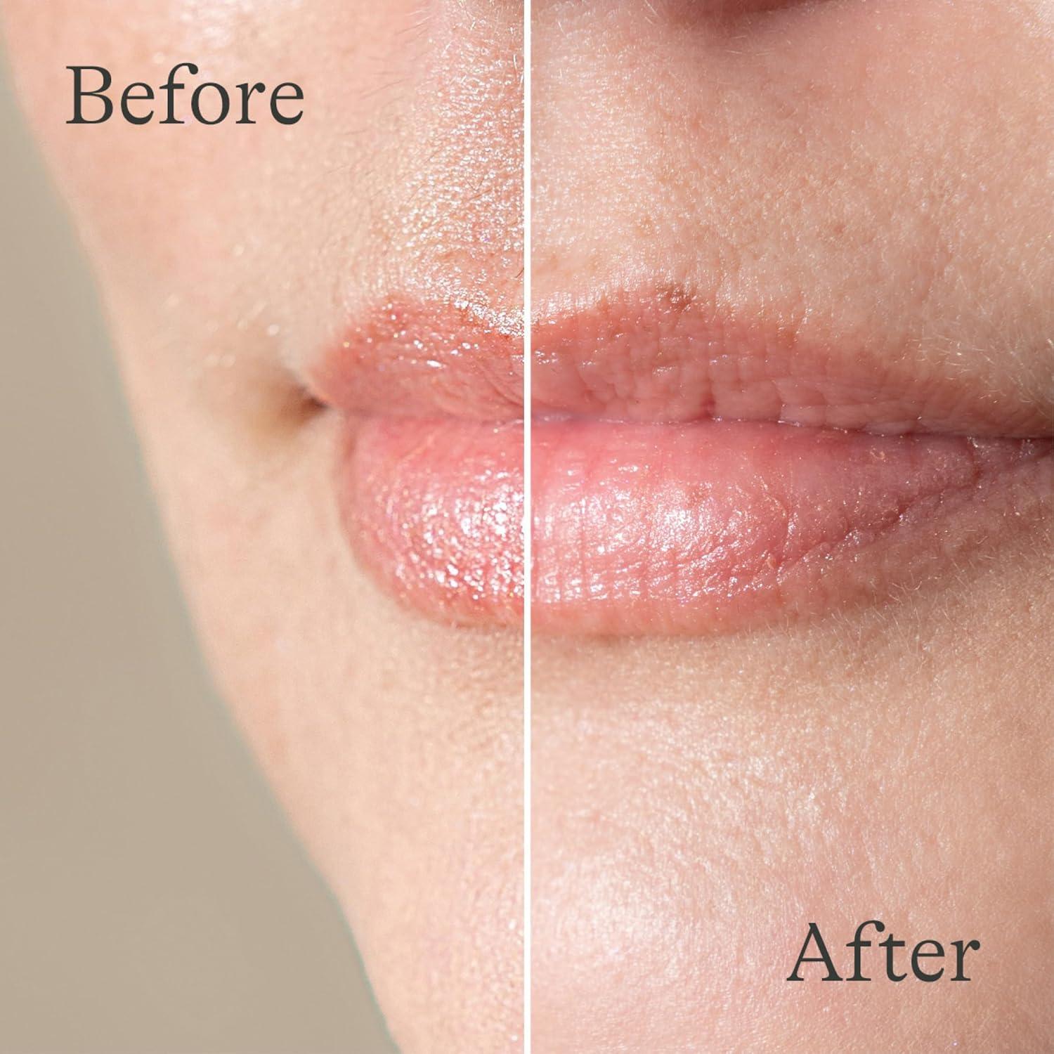 image:imageLansinoh Lanolin Lip Balm 2 Pack 025 oz Each UltraMoisturizing Lip Care with Natural Lanolin for Dry Chapped Lips